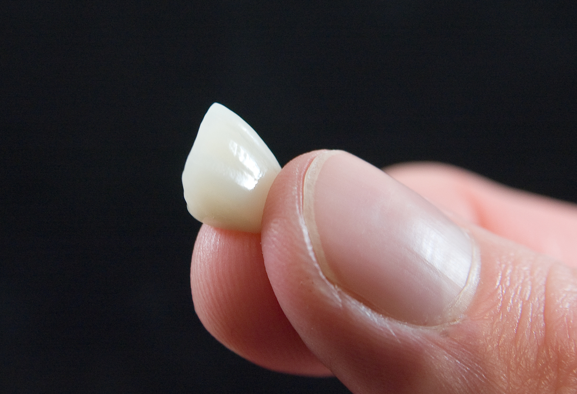 What are the Different Types of Dental Crowns That Exist Today?