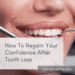 How To Regain Your Confidence After Tooth Loss